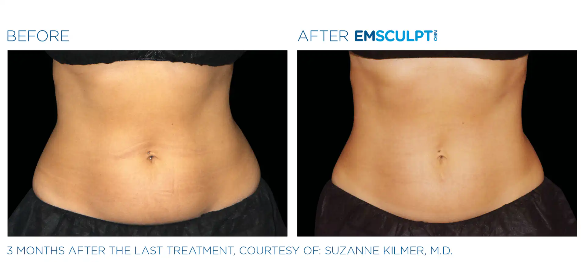 Before & After Eastchester Medical associates, Bronx NYC